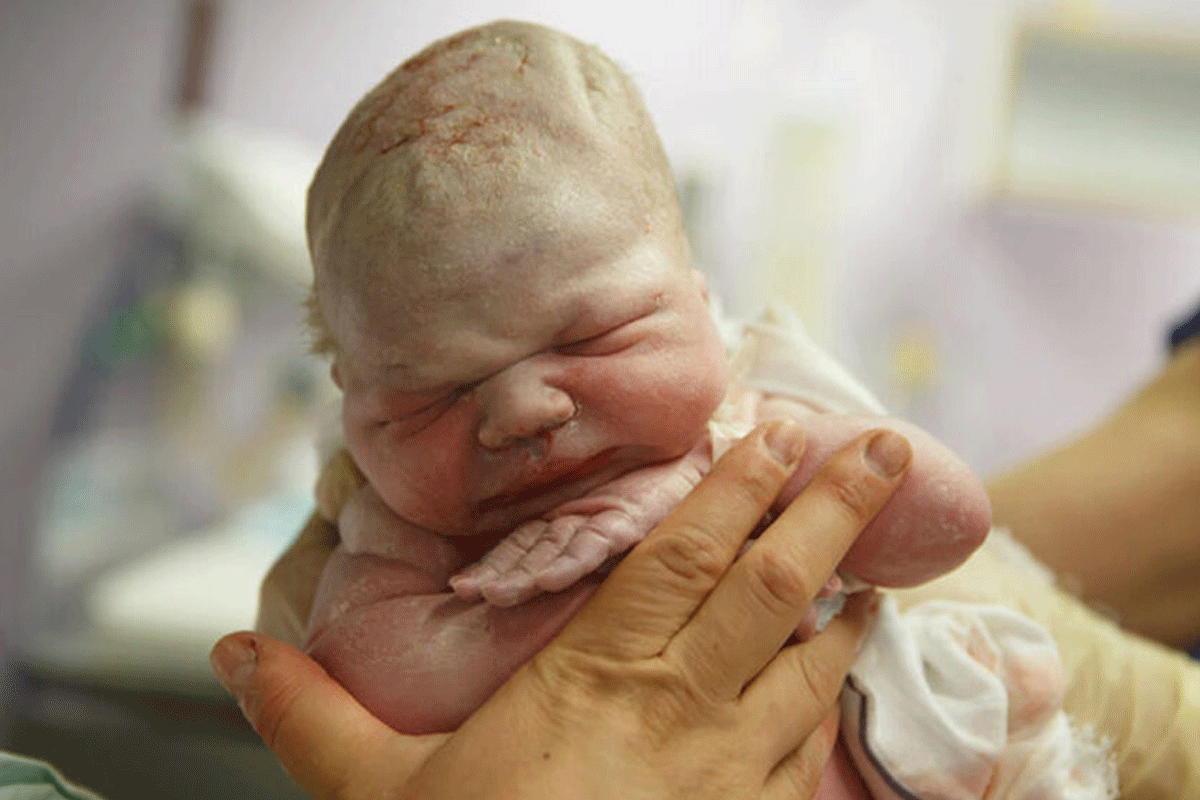 Fotoshoot bij de bevalling: Wel of niet?